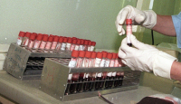 Волгоградцы и волжане могут анонимно сдать тест на ВИЧ
